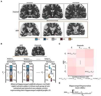 Piecing it together: atrophy profiles of hippocampal subfields relate to cognitive impairment along the Alzheimer’s disease spectrum